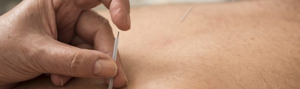 Técnica milenar da acupuntura traz benefícios para corpo e mente